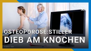 Osteoporose: Knochenschwund trifft auch Jüngere