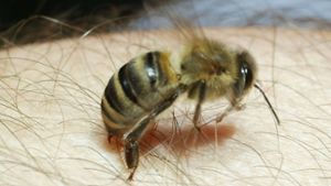 Piiieks! Autsch, das tut weh! Wenn (wie hier im Bild) eine   Honigbiene zusticht, gelangt ihr Gift  in den Körper und verursacht Röttungen und schmerzhafte Schwellungen. Foto: dpa