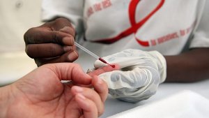 Die Zahl der HIV-Infektionen bleibt weiterhin hoch. Foto: dpa
