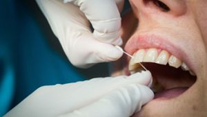 Verdacht auf Abzocke bei professioneller Zahnreinigung