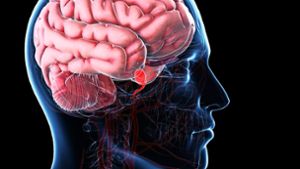 Das Gehirn wird über vier Arterien mit Blut versorgt. Doch wenn wichtige Gefäße reißen, wird es schnell gefährlich. Foto: mauritius images / Science Photo Library