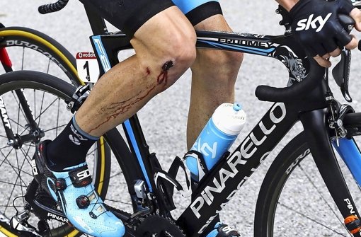 Schmerzhafte Wunde bei der  Vuelta: Chris Froome muss aufgeben Foto: DPA