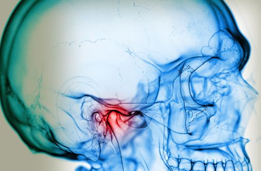 Viele Europäer leiden an  Kiefergelenkschmerzen. Foto: Sebastian Kaulitzki/Adobe Stock