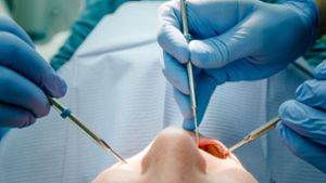 Zahnarzt wird Zulassung wegen heimlicher Nacktaufnahmen entzogen