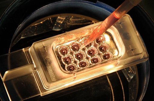 Wissenschaftler in Großbritannien dürfen die Gene menschlicher Embryonen künftig gezielt verändern. (Symbolfoto) Foto: dpa