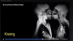 So sieht ein Kuss im MRT aus. Foto: Screenshot Youtube / ScienceNaturePage