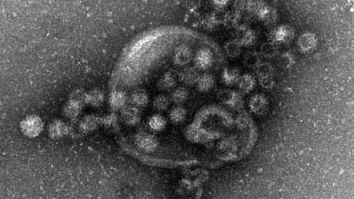 Norovirus Auslöser von Brechdurchfall