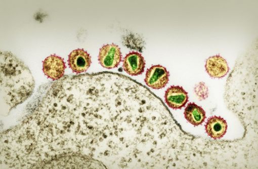 HI-Retroviren unter dem  Elektronenmikroskop: Bei einem  HIV-positiven Patienten sind 34 Monate nach einer  Stammzelltransplantation keine Viren mehr nachweisbar. Foto: R. Gelderblom/RKI/dpa
