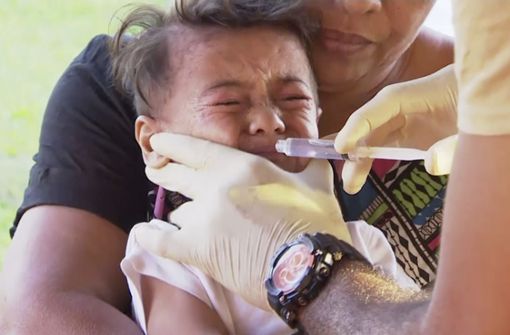 Ein Kind wird auf Samoa gegen Masern geimpft. Foto: dpa/Uncredited