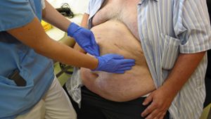 Von Fettleibigkeit oder Adipositas spricht man bei Frauen ab einem Bauchumfang von  88 Zentimentern, bei Männern ab 102 Zentimetern. Foto: dpa/David Ebener