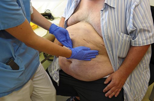 Von Fettleibigkeit oder Adipositas spricht man bei Frauen ab einem Bauchumfang von  88 Zentimentern, bei Männern ab 102 Zentimetern. Foto: dpa/David Ebener
