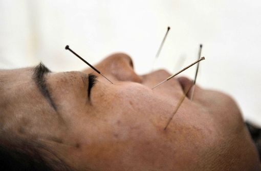 Akupunktur ist die bekannteste Heilmethode der traditionellen chinesischen Medizin, aber nicht die einzige. Auch gegen Corona kann TCM hilfreich sein. Foto: dpa/Mark