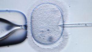 In einer Klinik in Utrecht könnten Eizellen mit dem Sperme des falschen Mannes befruchtet worden sien. Foto: dpa/Symbolbild