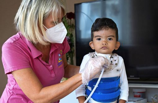 Der Kinderpflegedienst kommt auch zu Kindern, die ein Tracheostoma für die  geregelte Atmung brauchen. Foto:  
