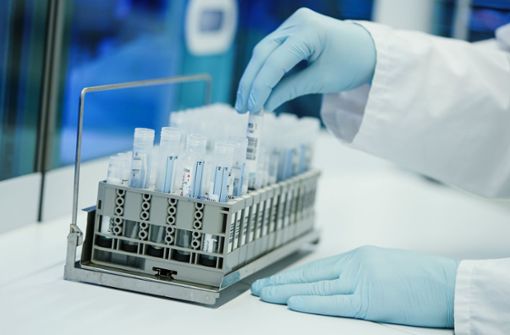 In Testlaboren werden auch am Wochenende PCR-Testergebnisse verarbeitet, im Landesgesundheitsamt nicht mehr. Foto: dpa/Uwe Anspach