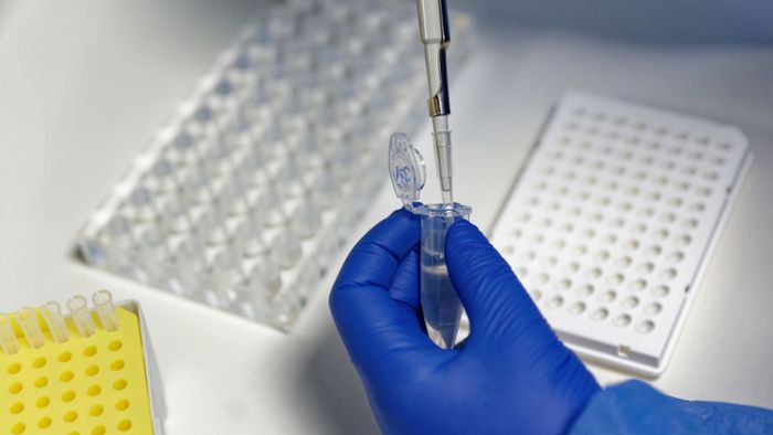 Anspruch auf PCR-Nachtestung bei Positiv-Test könnte wegfallen