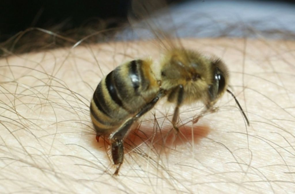 Piiieks! Autsch, das tut weh! Wenn (wie hier im Bild) eine   Honigbiene zusticht, gelangt ihr Gift  in den Körper und verursacht Röttungen und schmerzhafte Schwellungen. Foto: dpa