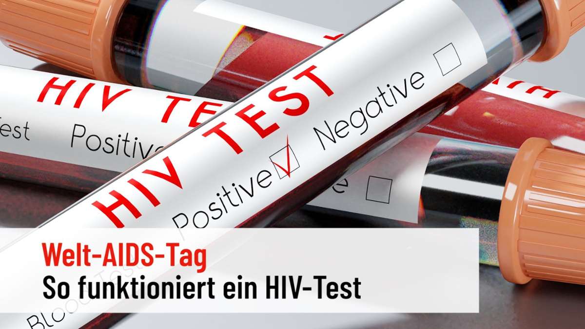 Welt-AIDS-Tag: So funktioniert ein HIV-Test