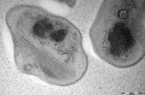 Das Bakterium Methylocapsa gorgona braucht nur Luft zum Leben. Foto: -MMSvenning, UiT The Arctic Univ