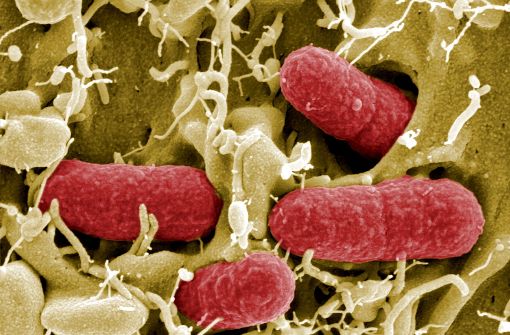 Eine Zwiebelmettwurst der Firma Franken-Gut Fleischwaren soll mit Ehec-Bakterien kontaminiert sein. (Symbolbild) Foto: HZI