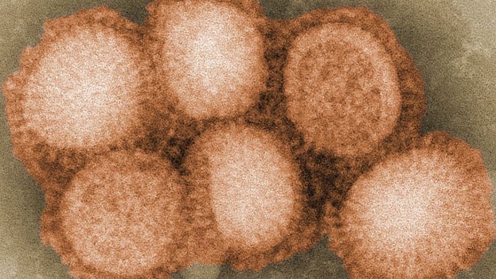 Seltener Fall von Schweinegrippe-Infektion beim Menschen