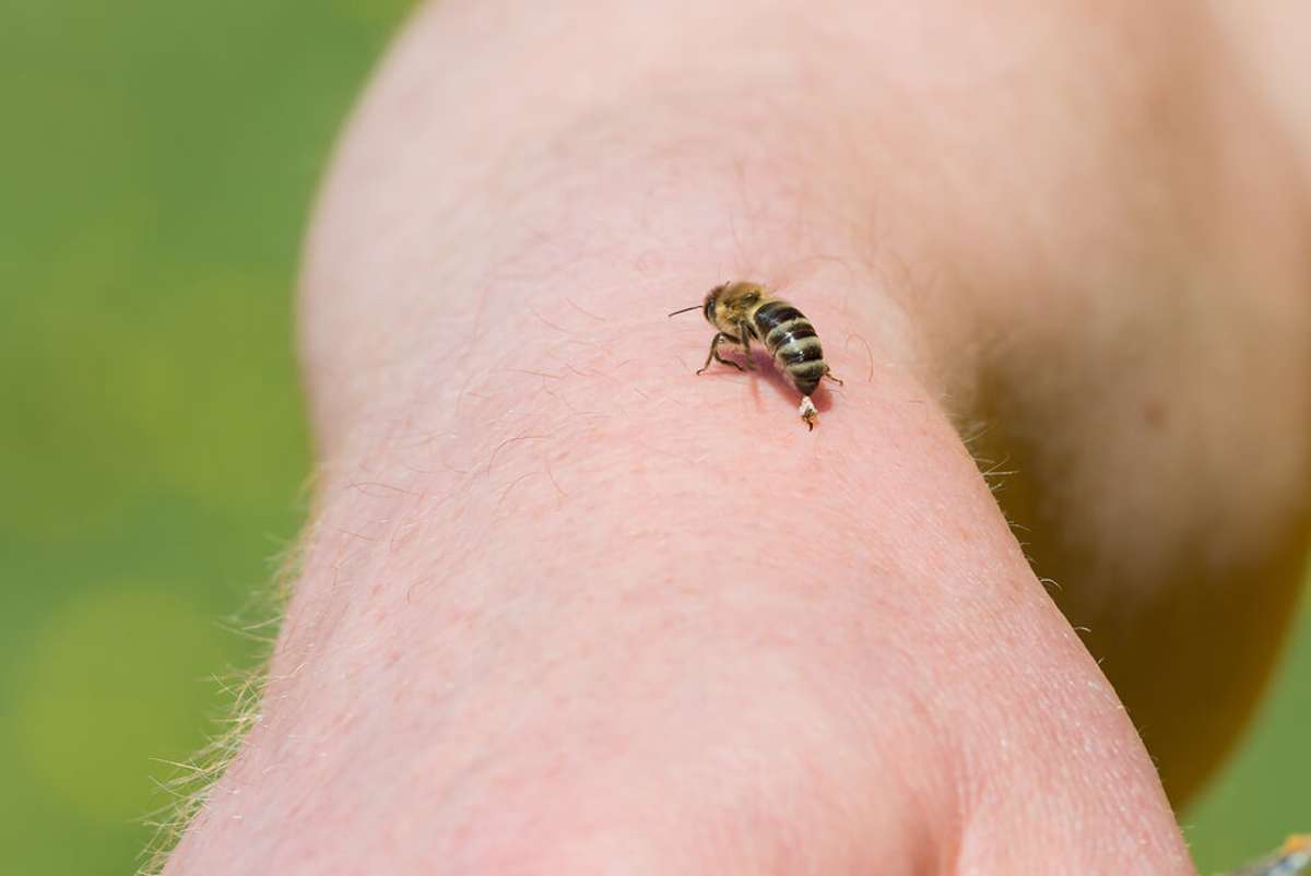 Vorschaubild zum Artikel Warum sterben Bienen nach dem Stich?