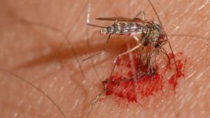 Was tun bei Mückenstichen?