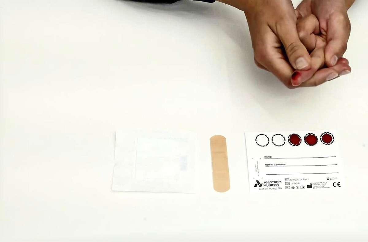 Das Blut für den Test kommt aus dem Finger Foto: Schittenhelm