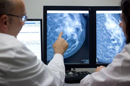 Röntgenbild einer weiblichen Brust: Wenn operiert werden muss, sind hohe Fallzahlen maßgeblich für den Behandlungserfolg. Foto: dpa