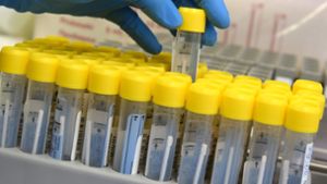 PCR-Tests werden in einem Labor ausgewertet. (Symbolbild) Foto: dpa/Waltraud Grubitzsch