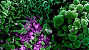 USA, Montana: Auf dieser vom US-Forschungszentrum „National Institute of Allergy and Infectious Diseases“ (NIAID) im US-Bundesstaat Montana zur Verfügung gestellten Aufnahme ist eine Zelle (grün) mit dem Coronavirus (SARS-CoV-2, violett) infiziert. Foto: Niaid/Europa Press/dpa