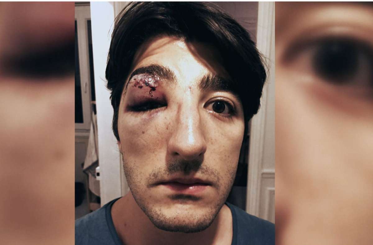 Einer der Protagonisten des Films, Arnaud,  beschließt, ein Foto seines verletzten Gesichts in sozialen Netzwerken zu veröffentlichen – Szene aus „Hass gegen queer“.