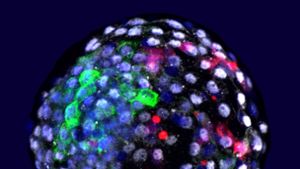 Das Bild zeigt eine Chimäre Mensch-Affe-Blastozyste. Wissenschaftler haben Embryonen aus Zellen von Mensch und Affe erzeugt. Foto: dpa/Weizhi Ji