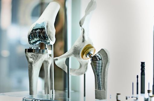 Knie-  und Hüftprothesen sind in den letzten Jahren haltbarer geworden. Foto:  