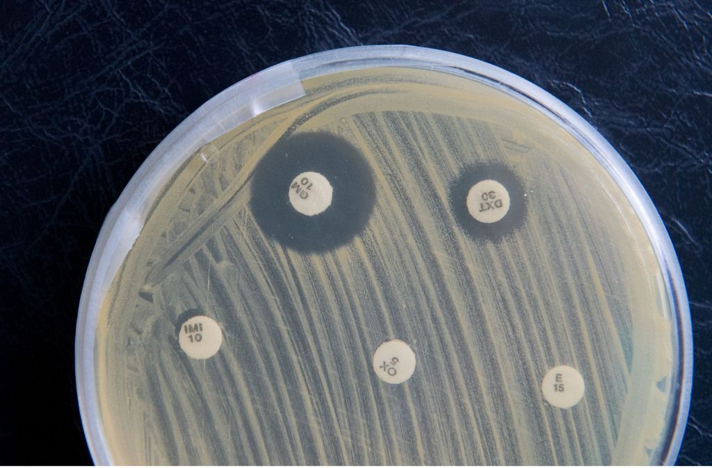 Bakterien sind überall – aber nicht alle sind schädlich. Foto: dpa