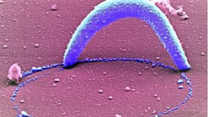 Der Malaria-Erreger im Elektronenmikroskop Foto: Max-Planck-Institut
