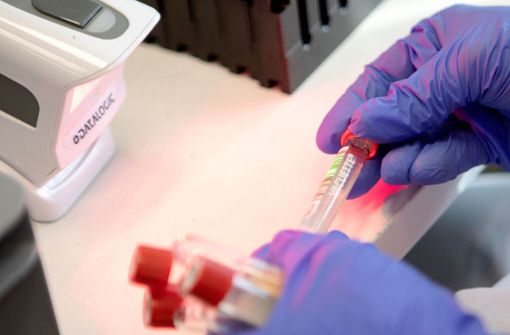 Das Angebot an PCR-Tests soll niedrigschwelliger werden. Foto: AFP/Alex Halada