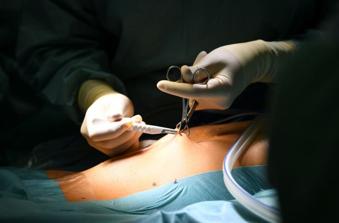 Medizin: Patient nach Stuhl-Transplantation in den USA gestorben