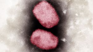 Elektronenmikroskopische, kolorierte Aufnahme von Affenpocken-Viren (Archivbild) Foto: dpa/Andrea Männel