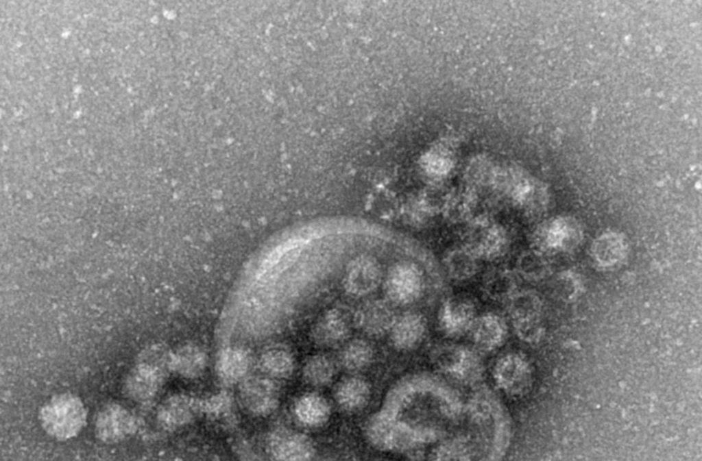 Norovirus: Übelst ansteckend - Wissen