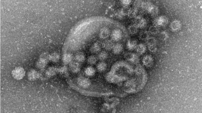 Das müssen Sie über das Norovirus wissen