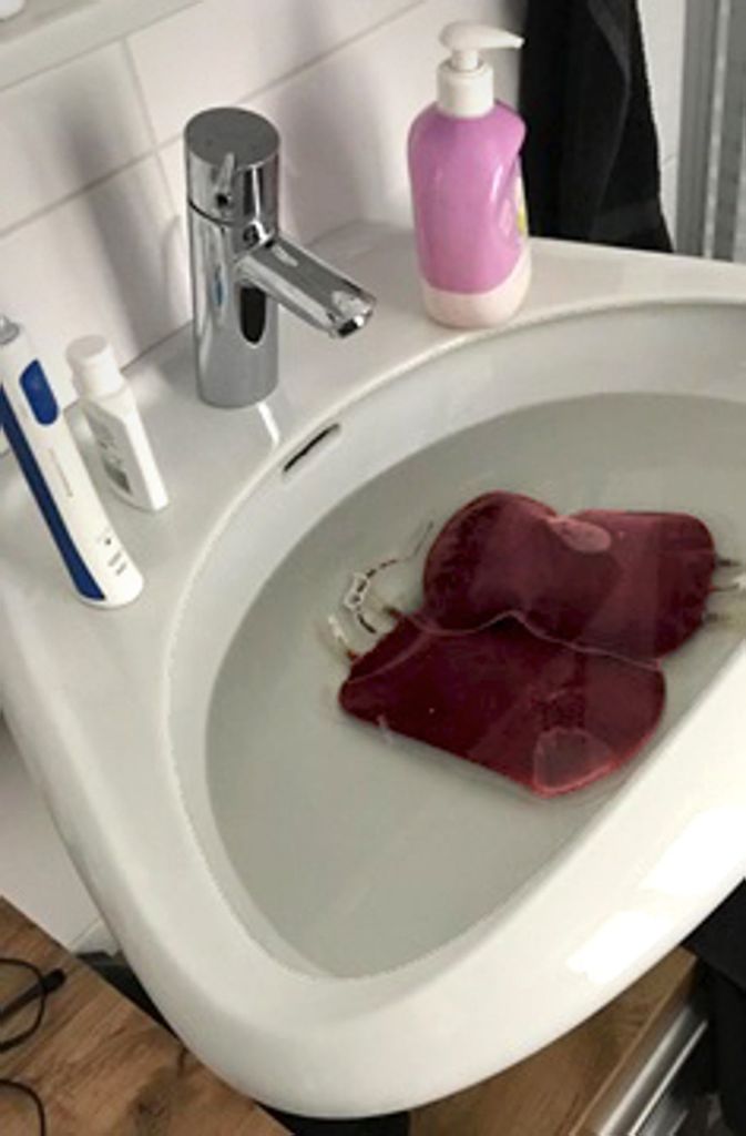 Blutbeutel in einem Waschbecken in Seefeld