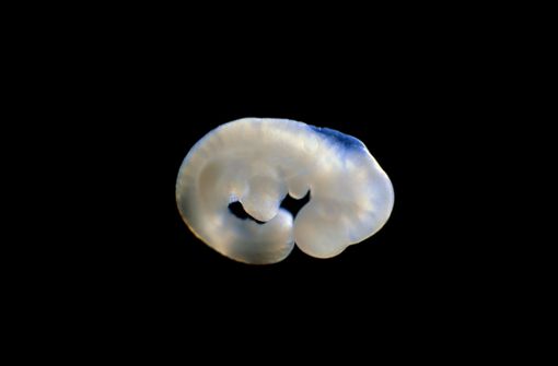 In solch einen Mäuseembryo  sollen  genetisch veränderte menschliche Stammzellen eingebaut werden. Foto: Getty Images/Science Photo Libra