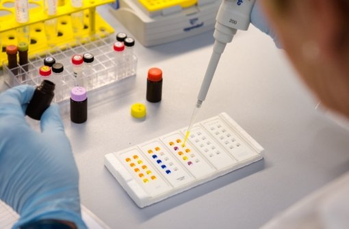 Im Labor werden Proben mit Antikörpern untersucht. Foto: dpa