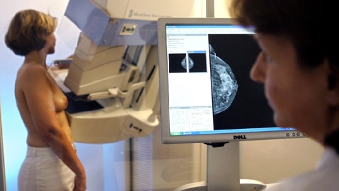 Studie bezweifelt Nutzen der Brustkrebsvorsorge