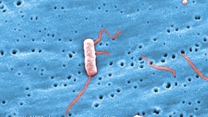 Sehr vergrößert sehen Legionellen so aus. Foto: Janice Haney Carr/CDC
