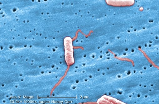 Sehr vergrößert sehen Legionellen so aus. Foto: Janice Haney Carr/CDC