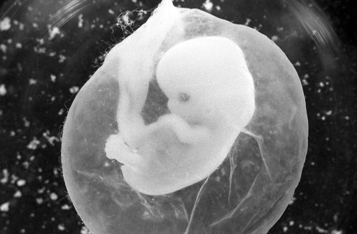 Das undatierte Foto zeigt einen sieben Wochen alten Fötus in einer Fruchtblase. Eine Ärztin in Gießen soll auf ihrer Website für Schwangerschaftsabbruch geworben haben. Nun muss sie sich vor Gericht verantworten. (Symbolfoto) Foto: dpa-Zentralbild