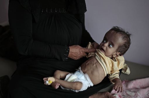 Der Krieg  im Jemen kostete  Zehntausende zivile Menschenleben, er brachte Hunger und Krankheit. Foto: Hani Mohammed/dpa