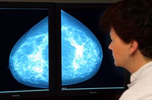 KI-Systeme könnten die rein diagnostische bildgebende Radiologie ablösen. Experten sagen: Sie sind wohl schon heute bei der Erkennung von Tumoren auf Bildern wesentlich besser als Ärzte. Foto: dpa